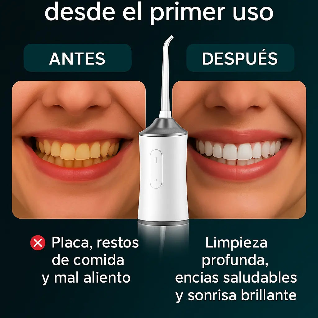 AquaSmile Pro - Elimina residuos y mal aliento en segundos