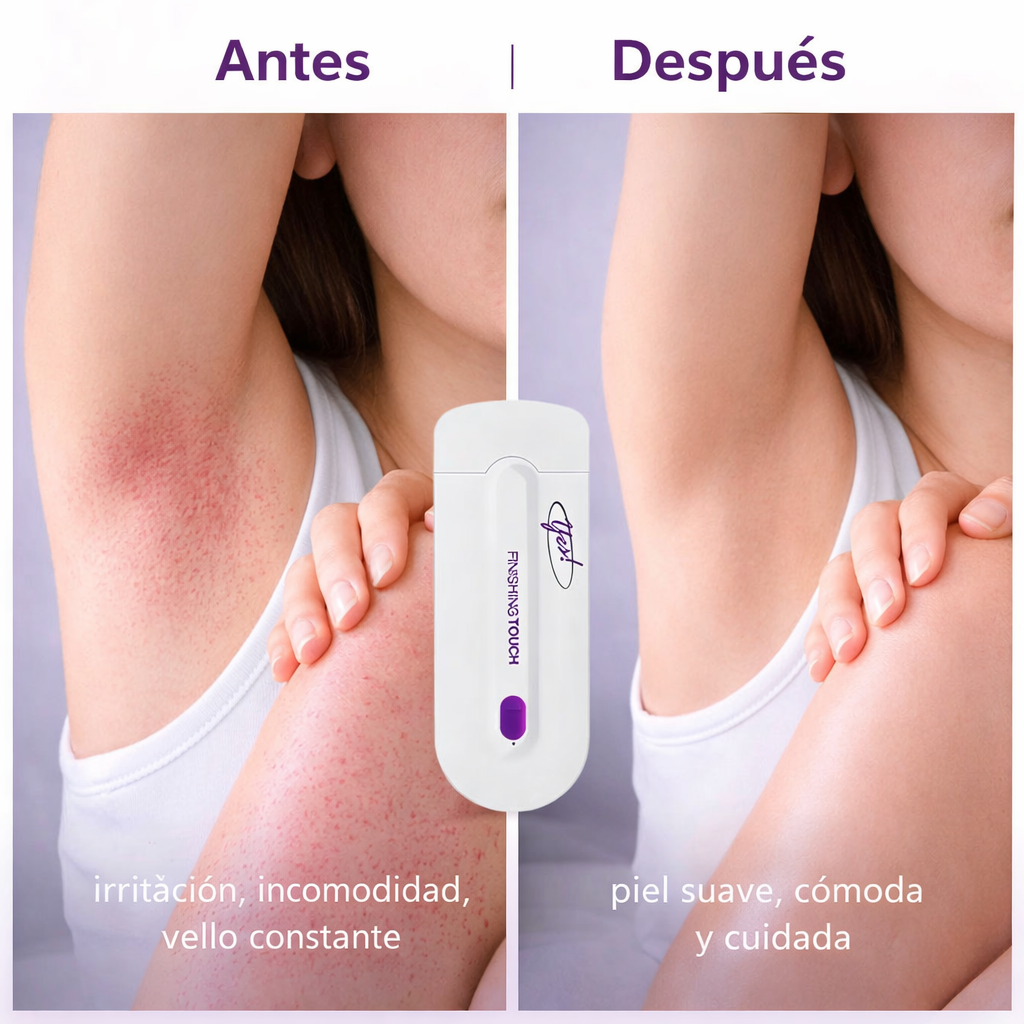 Depiladora profesional Yes!